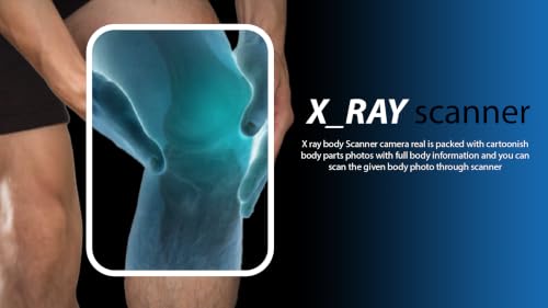 Body Scanner Xray BodyScanner Xray Body Filterの特徴・詳細 画像